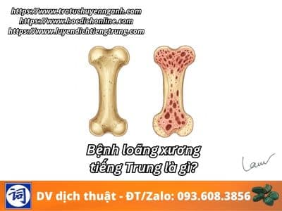Bệnh loãng xương tiếng Trung là gì? 1 Bệnh loãng xương tiếng Trung là gì?