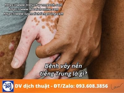 Bệnh vảy nến tiếng Trung là gì? 1 Bệnh vảy nến tiếng Trung là gì?