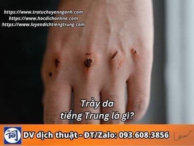 Trầy da tiếng Trung là gì? 1 Trầy da tiếng Trung là gì?