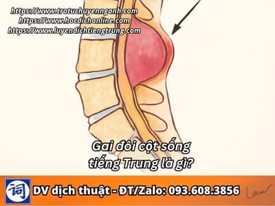 Gai đôi cột sống tiếng Trung là gì? 1 Gai đôi cột sống tiếng Trung là gì?